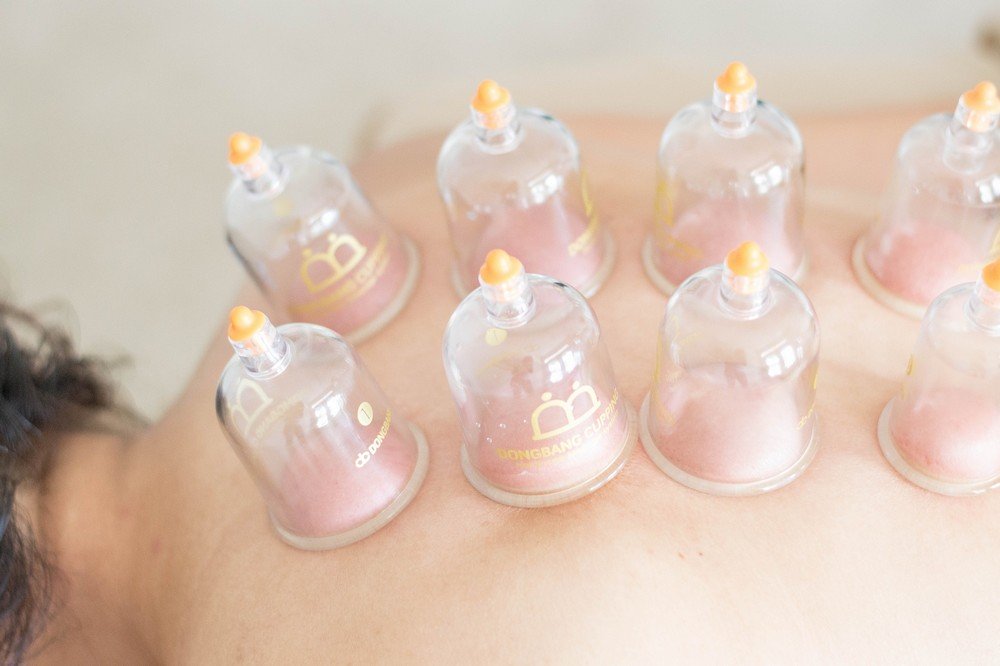 Cupping massage